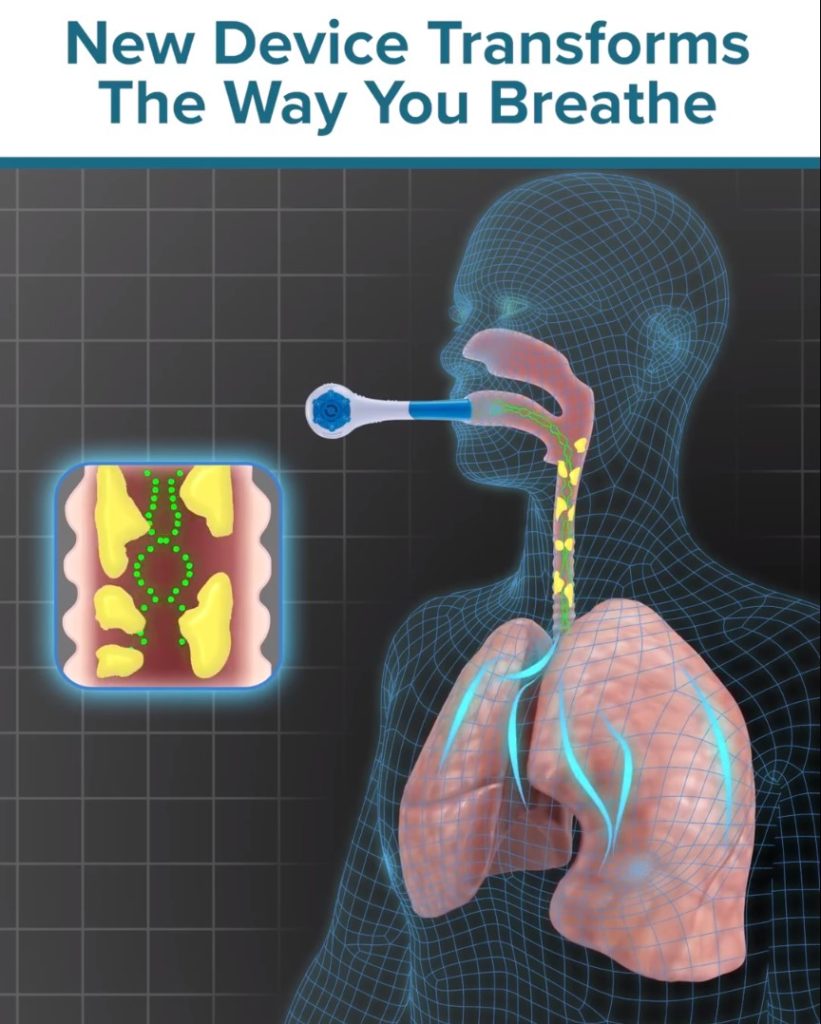 The Breather Device